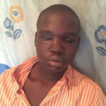 A 19 years old boys eyes removed by ritualists