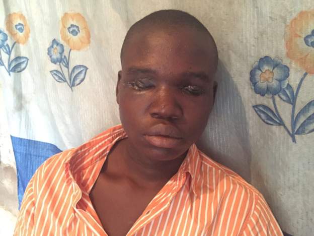 A 19 years old boys eyes removed by ritualists