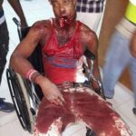 Nigerian mans face torn by mobile phone explosion