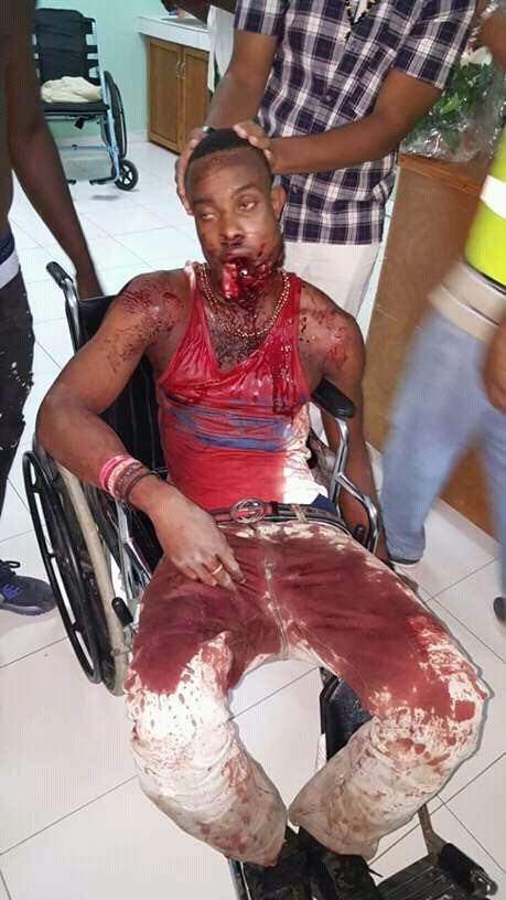 Nigerian mans face torn by mobile phone