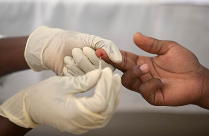 malaria diagosis