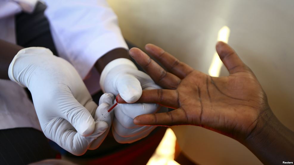 Scientists Achieve Functional Cure for HIV in Monkey Model