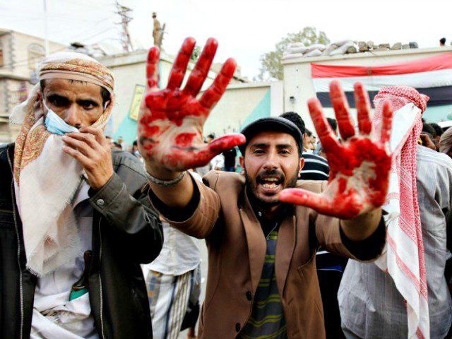 Saudi Led War in Yemen