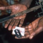 fgm