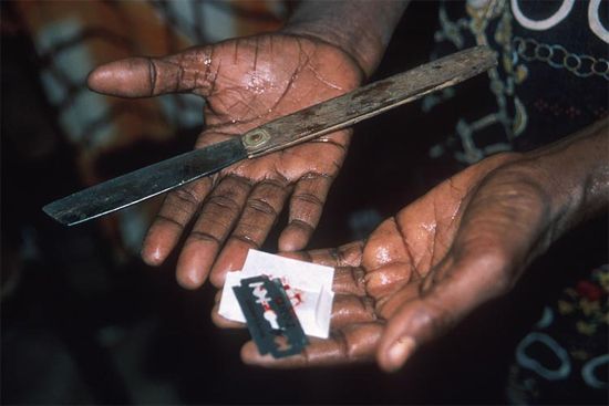 fgm